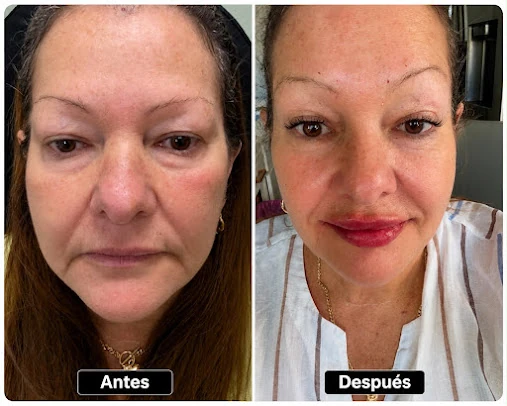 Full-face comparison published by AJ19 on Google, with the original Antes and Después labels.