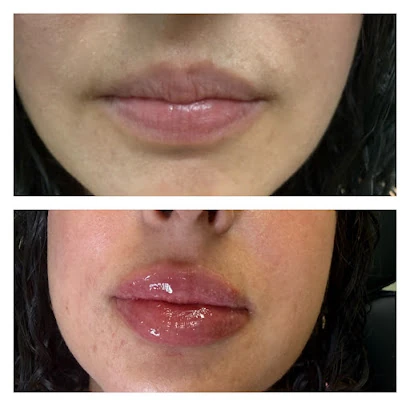 Frontal lip comparison published by AJ19 on Google.